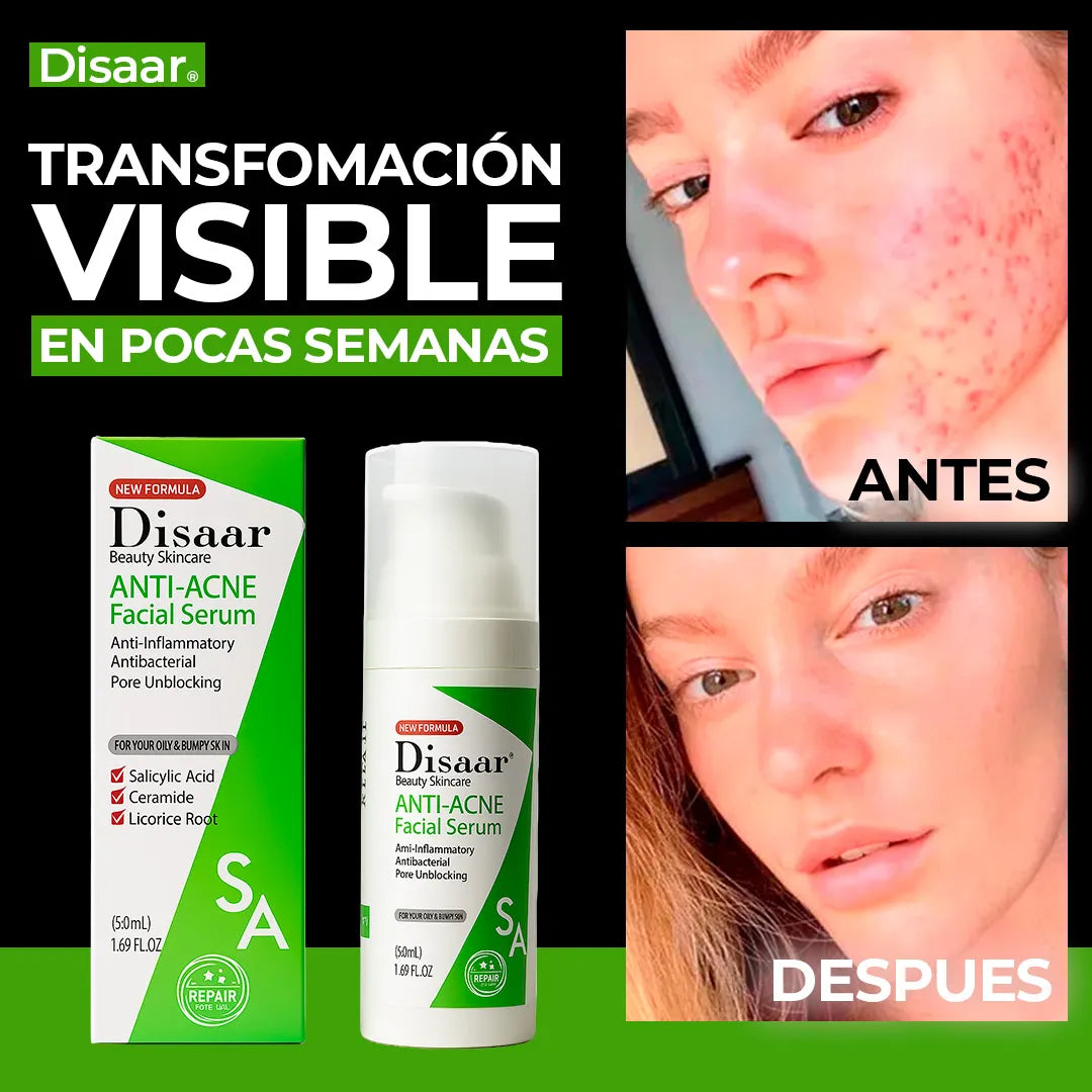 TU SÚPER SERUM ANTIACNÉ - DISAAR