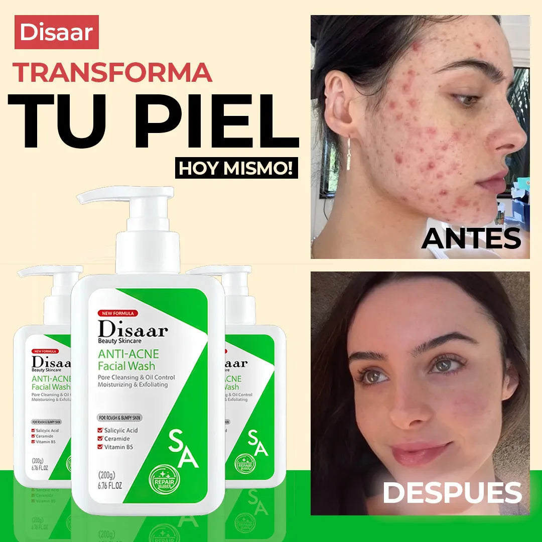 Súper Crema Anti Acné Disaar Premium