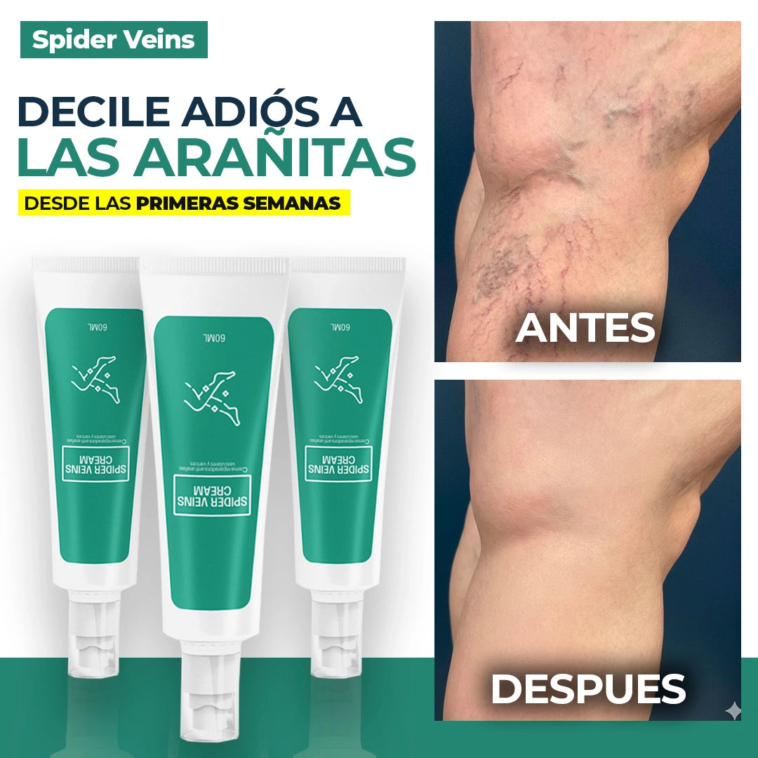 Crema Spider Veins - Relaja y disminuye las venas agrandadas