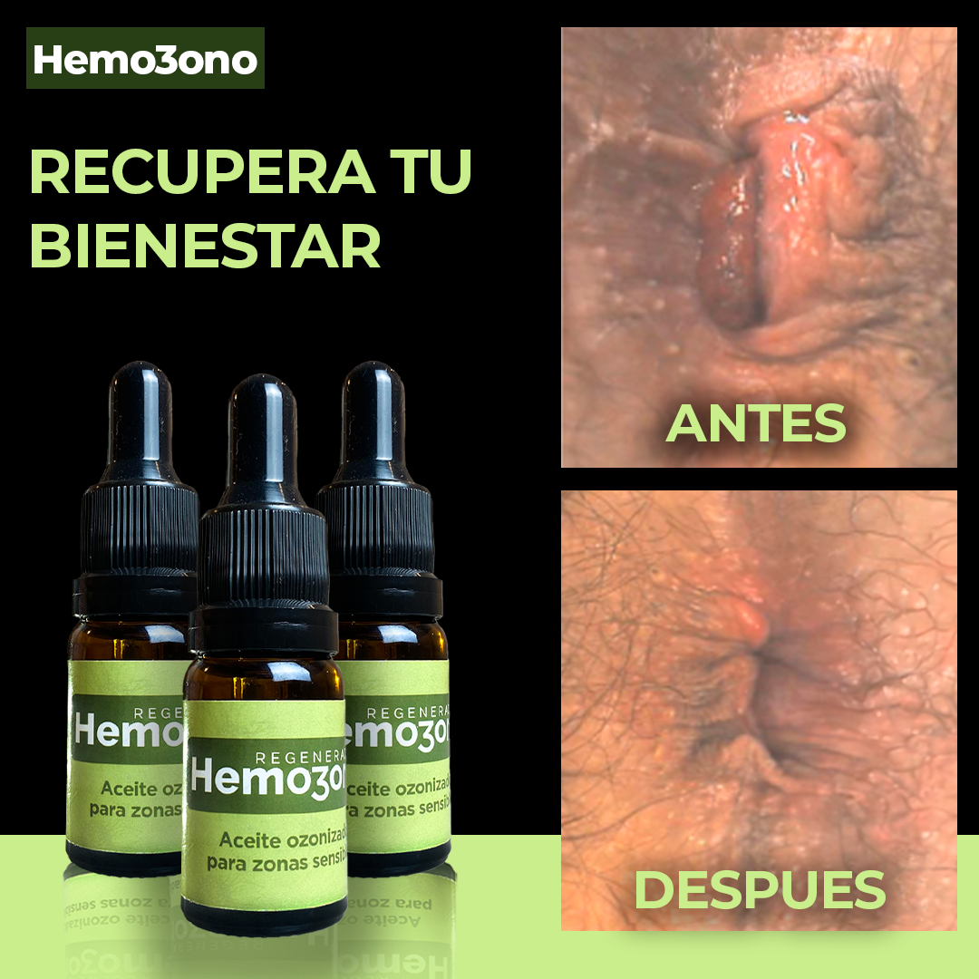 Hemozono | Cuidado Natural para las Hemorroides